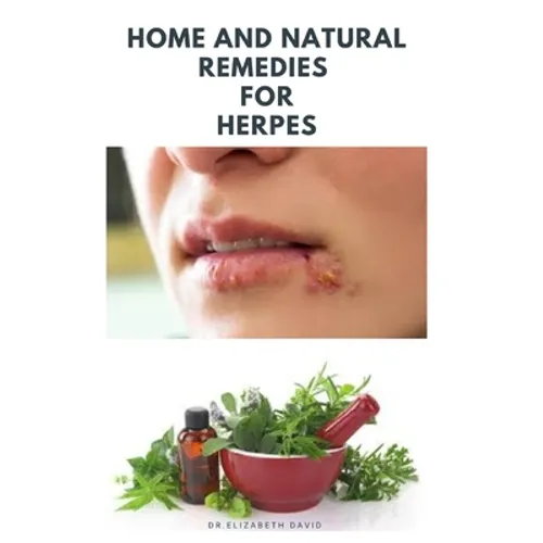 Home and Natural Remedies for Herpes: The Best Herbal And Natural Remedies To Get Rid Of All Form Of Herpes Virus - Paperback