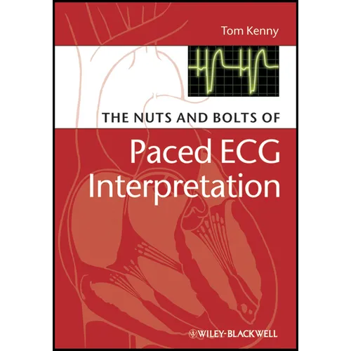 The Nuts and Bolts of Paced ECG Interpretation - Paperback