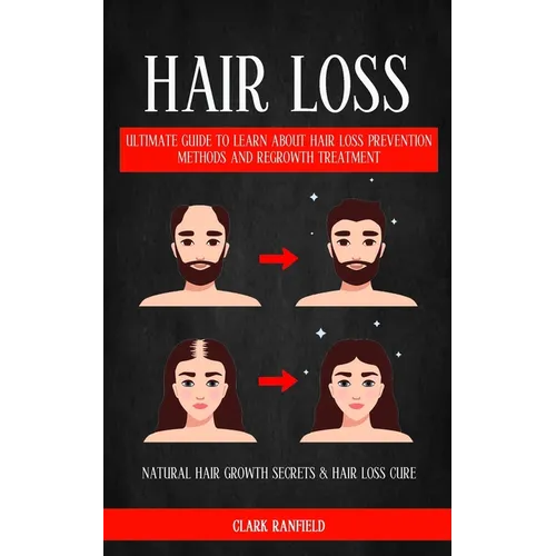 Hair Loss: Ultimate Guide To Learn About Hair Loss Prevention Methods And Regrowth Treatment (Natural Hair Growth Secrets & Hair Loss Cure) - Paperback