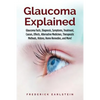 Glaucoma Explained: Glaucoma Facts, Diagnosis, Symptoms, Treatment, Causes, Effects, Alternative Medicines, Therapeutic Methods, History, - Paperback