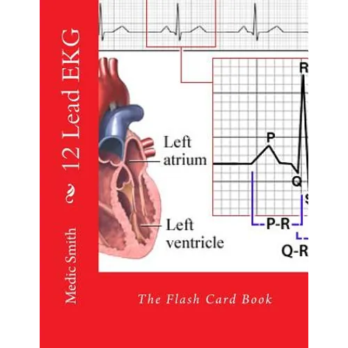 12 Lead EKG: The Flash Card Book - Paperback