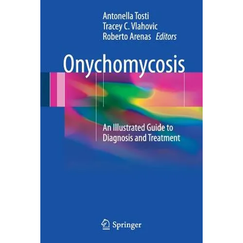 Onychomycosis: An Illustrated Guide to Diagnosis and Treatment - Paperback