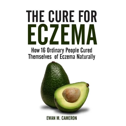 The Cure for Eczema - Hardcover