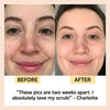 Travel-Size Skincare Bundle