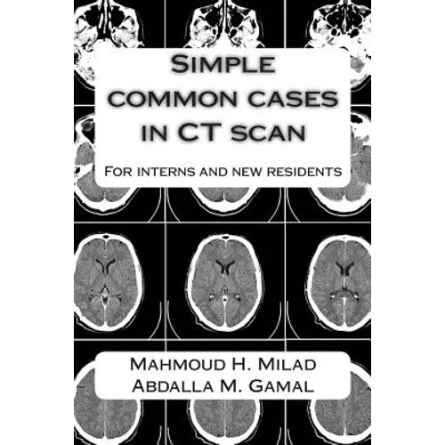 Simple common cases in CT scan: For interns and new residents - Paperback