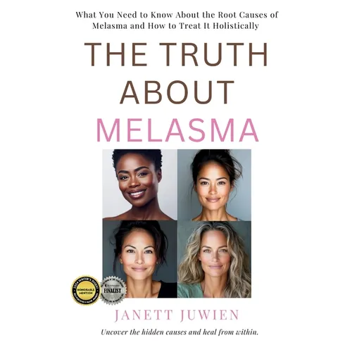 The Truth About Melasma: What You Need to Know About the Root Causes of Melasma and How to Treat It Holistically - Paperback