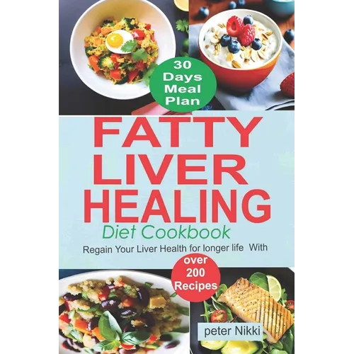 Fatty Liver Healing Diet Cookbook: Regain your liver health for longer life with over 200 Recipes - Paperback