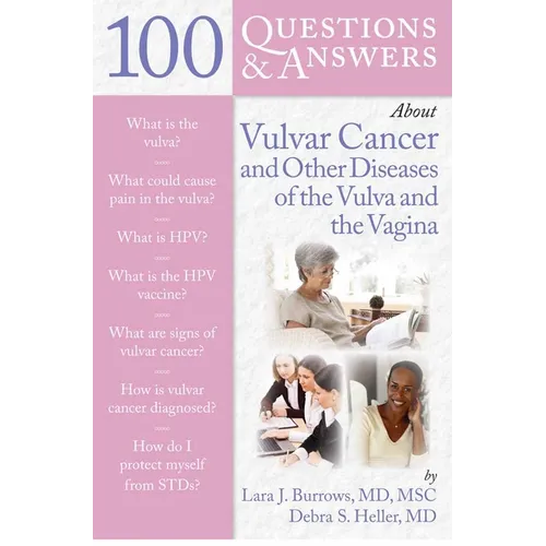100 Questions & Answers about Vulvar Cancer and Other Diseases of the Vulva and Vagina - Paperback