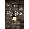 The Scars Beneath My Skin: Overcoming the Struggle Within - Paperback