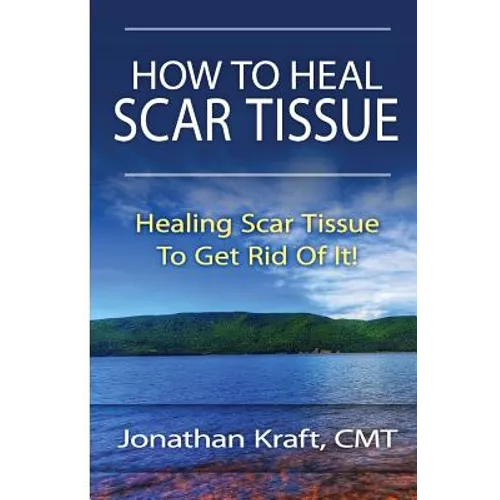 How to Heal Scar Tissue: How to Heal Your Own Scar Tissue And Get Rid Of It! - Paperback
