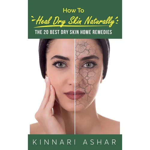 How to Heal Dry Skin Naturally: The 20 Best Dry Skin Home Remedies - Hardcover