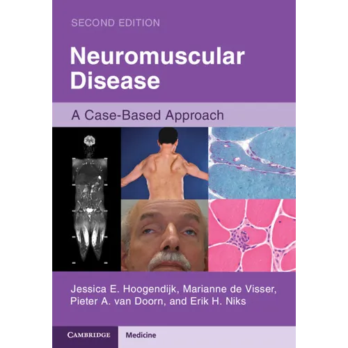 Neuromuscular Disease - Paperback