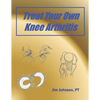 Treat Your Own Knee Arthritis - Paperback
