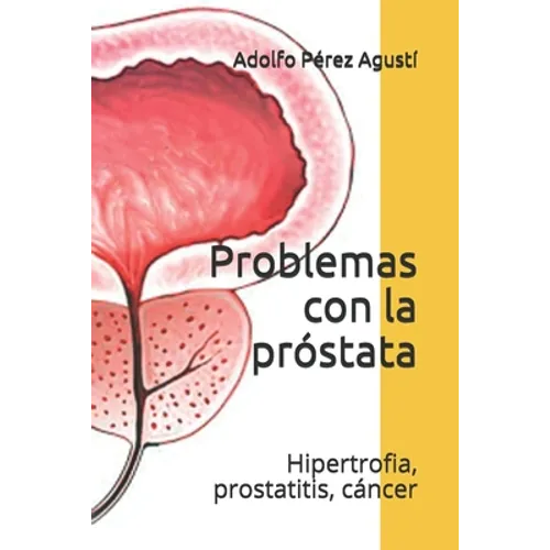 Problemas con la próstata: Hipertrofia, prostatitis, cáncer - Paperback