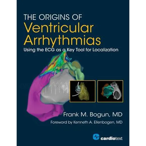 The Origins of Ventricular Arrhythmias: Using the ECG as a Key Tool for Localization - Paperback