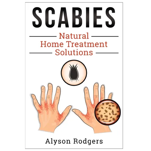 Scabies Natural Home Treatment Solution - Paperback