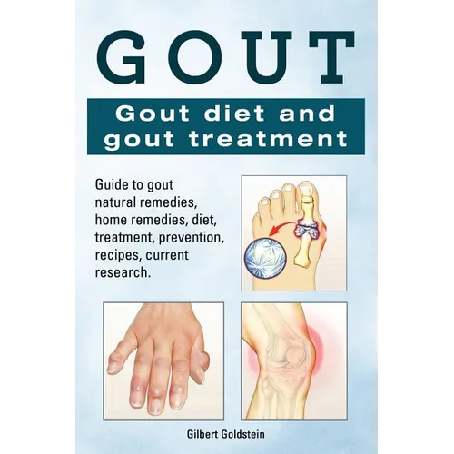 Gout. Gout diet and gout treatment. Guide to gout natural remedies, home remedies, diet, treatment, prevention, recipes, current research. - Paperback