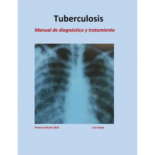 Tratamiento de Tuberculosis: Manual de diagnóstico y tratamiento - Paperback
