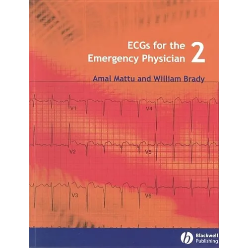 Ecgs for the Emergency Physician 2 - Paperback
