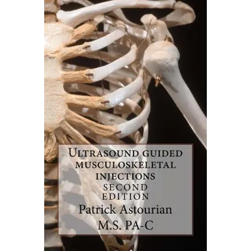 Ultrasound guided musculoskeletal injections - Paperback