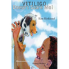 Vitiligo Doesn't Scare Me - Paperback