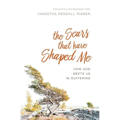 The Scars That Have Shaped Me: How God Meets Us in Suffering - Paperback