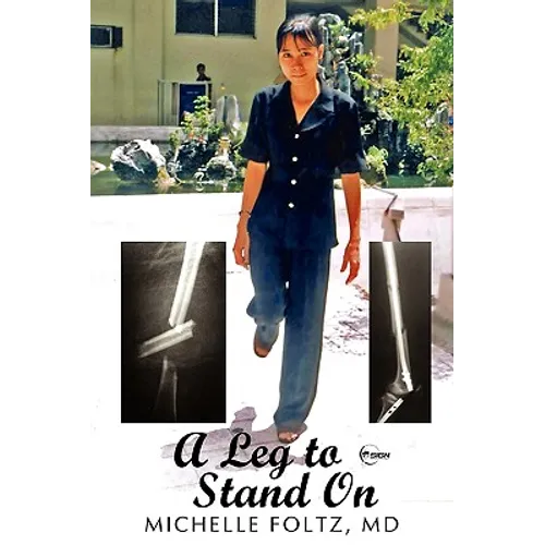 A Leg to Stand On - Paperback