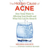 The Hidden Cause of Acne: How Toxic Water Is Affecting Your Health and What You Can Do about It - Paperback