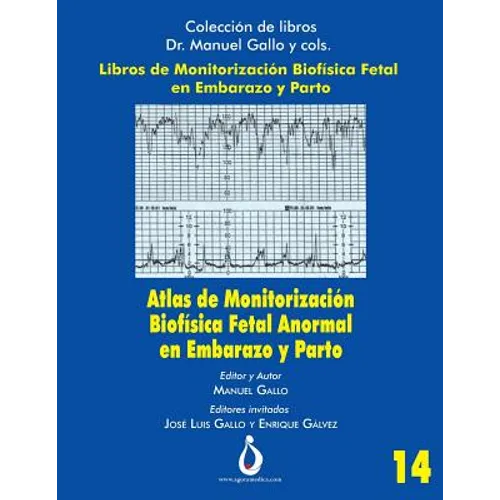 Atlas de Monitorizacion Biofisica Fetal Anormal En El Embarazo Y Parto - Paperback