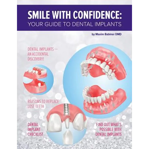 Smile with confidence: Your guide to dental implants - Paperback