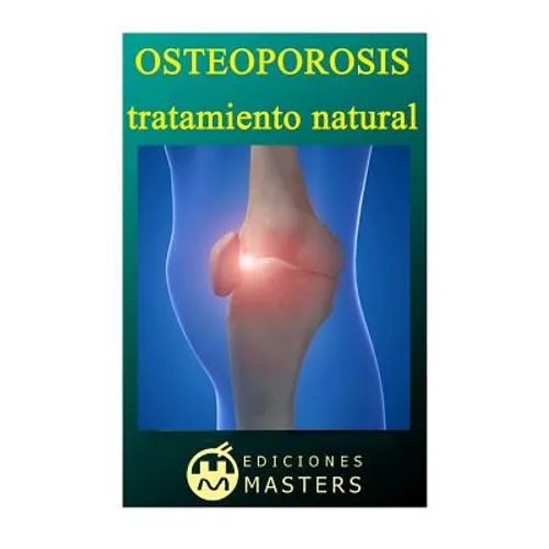 Osteoporosis: Tratamiento natural - Paperback