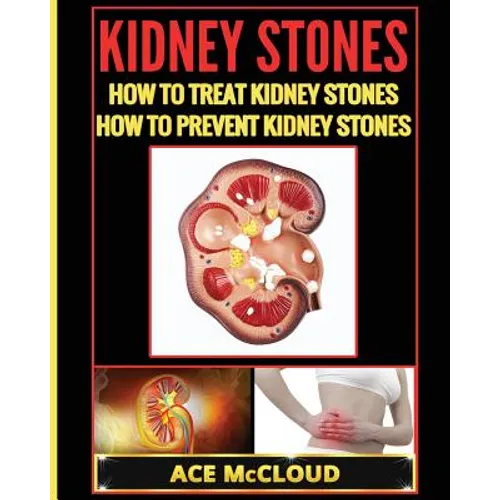 Kidney Stones: How To Treat Kidney Stones: How To Prevent Kidney Stones - Paperback