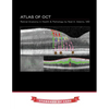 Atlas of OCT: Retinal Anatomy in Health & Pathology - Paperback