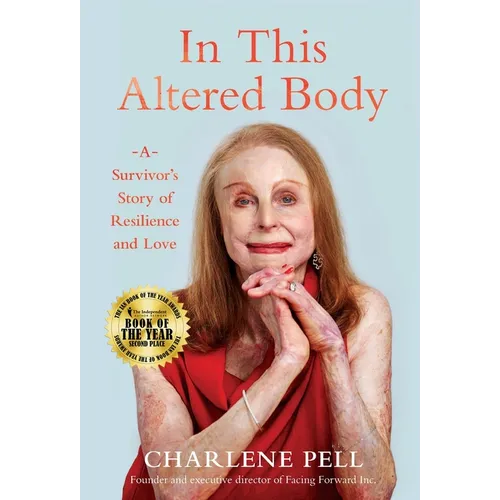In This Altered Body: A Survivor's Story of Resilience and Love - Hardcover