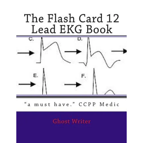 The Flash Card 12 Lead EKG - Paperback