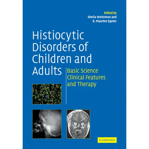 Histiocytic Disorders of Children and Adults: Basic Science, Clinical Features and Therapy - Paperback