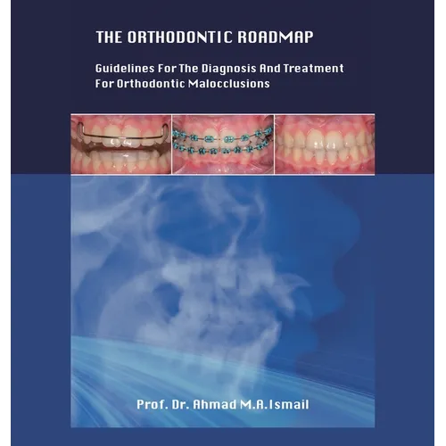 The Orthodontic Roadmap: Guidelines for the Diagnosis and Treatment of Orthodontic Malocclusions - Hardcover