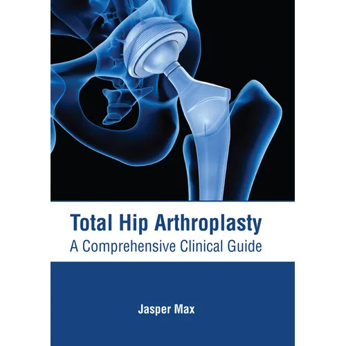 Total Hip Arthroplasty: A Comprehensive Clinical Guide - Hardcover
