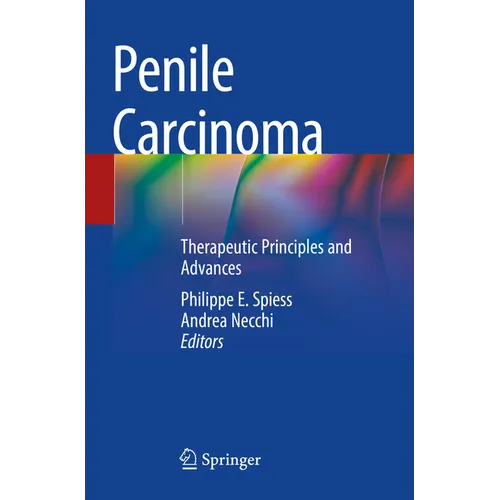 Penile Carcinoma: Therapeutic Principles and Advances - Paperback